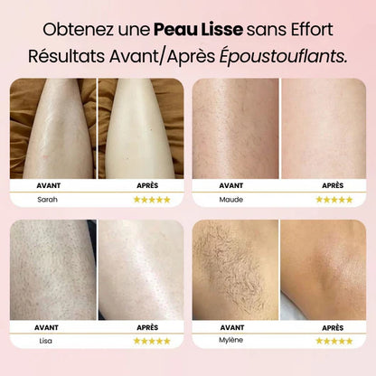 LadyCut™ – Fini les irritations et les coupures